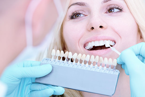 Estetica del sorriso